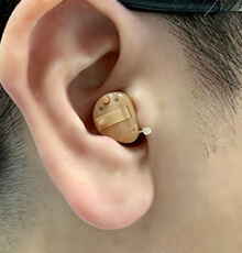 耳穴型トラスト